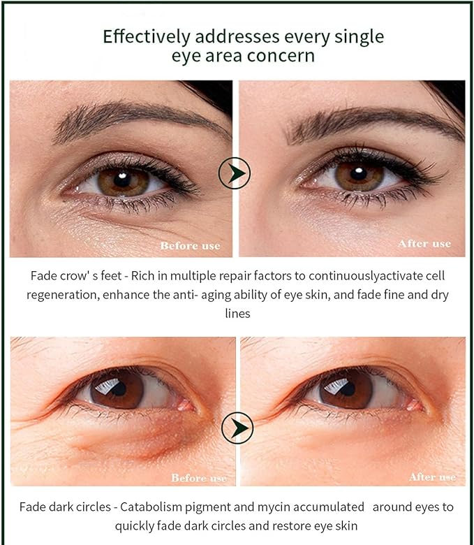 Time Eraser Eye Essence Oil – 10ml | Anti-Aging Under-Eye Care